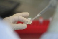 亳州新冠肺炎核酸检测费用大幅下调